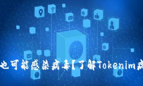 你知道吗？支付宝也可能感染病毒？了解Tokenim病毒的危害与防护！