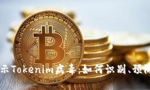 手机提示Tokenim病毒：如何识别、预防与处理